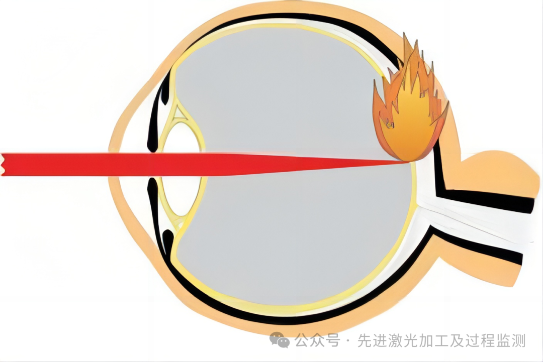 激光使用安全与防护